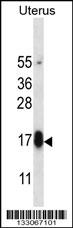 GPHB5 Antibody (C-term) (Cat. #AP13233b) western blot analysis in human normal Uterus tissue lysates (35ug/lane).This demonstrates the GPHB5 antibody detected the GPHB5 protein (arrow).