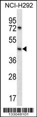 SGPP1 Antibody (N-term) (Cat. #AP13228a) western blot analysis in NCI-H292 cell line lysates (35ug/lane).This demonstrates the SGPP1 antibody detected the SGPP1 protein (arrow).