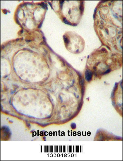 SGPP1 Antibody (N-term) (Cat. #AP13228a)immunohistochemistry analysis in formalin fixed and paraffin embedded human placenta tissue followed by peroxidase conjugation of the secondary antibody and DAB staining.This data demonstrates the use of SGPP1 Antibody (N-term) for immunohistochemistry. Clinical relevance has not been evaluated.