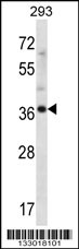 ANKRD60 Antibody (C-term) (Cat. #AP13221b) western blot analysis in 293 cell line lysates (35ug/lane).This demonstrates the ANKRD60 antibody detected the ANKRD60 protein (arrow).