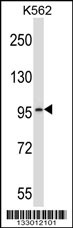 PDE6A Antibody (Center) (Cat. #AP13220c) western blot analysis in K562 cell line lysates (35ug/lane).This demonstrates the PDE6A antibody detected the PDE6A protein (arrow).