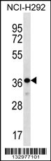 THAP8 Antibody (Center) (Cat. #AP13209c) western blot analysis in NCI-H292 cell line lysates (35ug/lane).This demonstrates the THAP8 antibody detected the THAP8 protein (arrow).