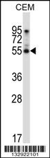 PALMD Antibody (N-term) (Cat. #AP13201a) western blot analysis in CEM cell line lysates (35ug/lane).This demonstrates the PALMD antibody detected the PALMD protein (arrow).