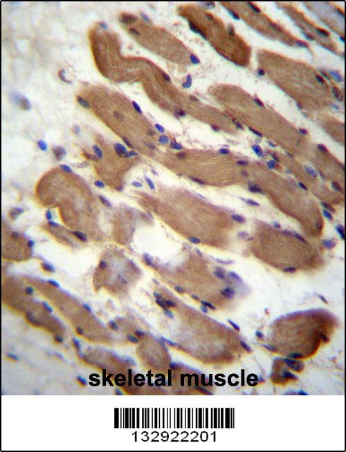 PALMD Antibody (N-term) (Cat. #AP13201a)immunohistochemistry analysis in formalin fixed and paraffin embedded human skeletal muscle followed by peroxidase conjugation of the secondary antibody and DAB staining.This data demonstrates the use of PALMD Antibody (N-term) for immunohistochemistry. Clinical relevance has not been evaluated.