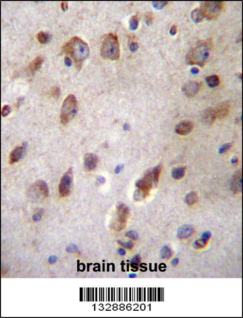 B3GNT1 Antibody (C-term) (Cat. #AP13200b)immunohistochemistry analysis in formalin fixed and paraffin embedded human brain tissue followed by peroxidase conjugation of the secondary antibody and DAB staining.This data demonstrates the use of B3GNT1 Antibody (C-term) for immunohistochemistry. Clinical relevance has not been evaluated.