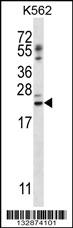 PSORS1C1 Antibody (N-term) (Cat. #AP13194a) western blot analysis in K562 cell line lysates (35ug/lane).This demonstrates the PSORS1C1 antibody detected the PSORS1C1 protein (arrow).