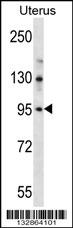 LRRC37B Antibody (C-term) (Cat. #AP13189b) western blot analysis in human normal Uterus tissue lysates (35ug/lane).This demonstrates the LRRC37B antibody detected the LRRC37B protein (arrow).