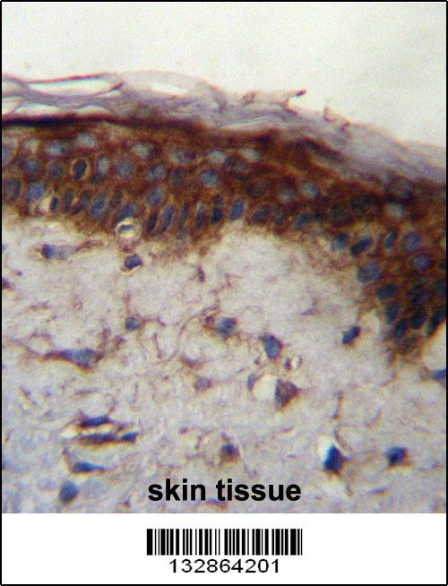 LRRC37B Antibody (C-term) (Cat. #AP13189b)immunohistochemistry analysis in formalin fixed and paraffin embedded human skin tissue followed by peroxidase conjugation of the secondary antibody and DAB staining.This data demonstrates the use of LRRC37B Antibody (C-term) for immunohistochemistry. Clinical relevance has not been evaluated.