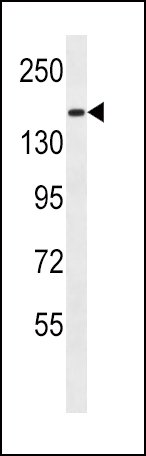 PCDH9 Antibody (C-term) (Cat. #AP13185b) western blot analysis in MDA-MB435 cell line lysates (35ug/lane).This demonstrates the PCDH9 antibody detected the PCDH9 protein (arrow).