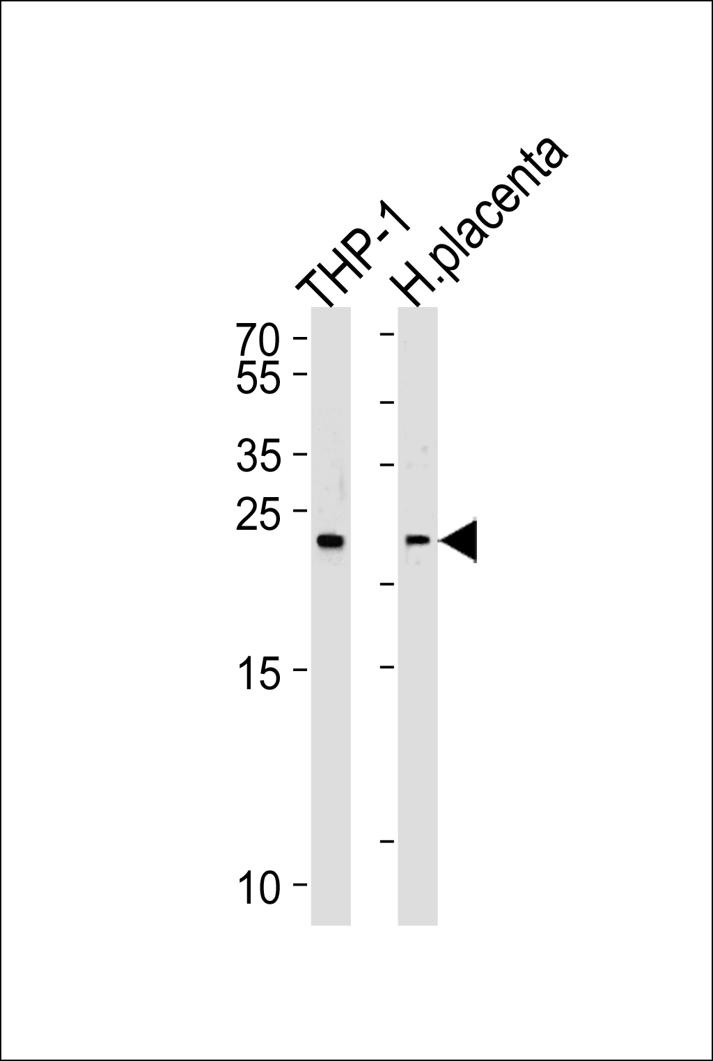 Western blot analysis of lysates from THP-1 cell line and human placenta tissue lysates (from left to right), using HEBP2 Antibody (N-term)(Cat. #AP13181a). AP13181a was diluted at 1:1000 at each lane. A goat anti-rabbit IgG H&L(HRP) at 1:5000 dilution was used as the secondary antibody. Lysates at 35ug per lane.