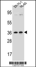 LUZP2 Antibody (N-term) (Cat. #AP13174a) western blot analysis in ZR-75-1,HL-60 cell line lysates (35ug/lane).This demonstrates the LUZP2 antibody detected the LUZP2 protein (arrow).