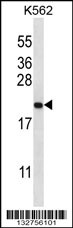 GAGE2B Antibody (N-term) (Cat. #AP13173a) western blot analysis in K562 cell line lysates (35ug/lane).This demonstrates the GAGE2B antibody detected the GAGE2B protein (arrow).