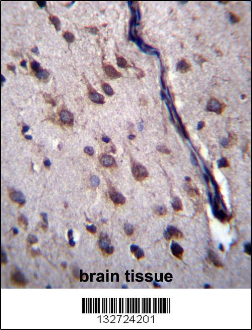 DYSFIP1 Antibody (N-term) (Cat. #AP13166a)immunohistochemistry analysis in formalin fixed and paraffin embedded human brain tissue followed by peroxidase conjugation of the secondary antibody and DAB staining.This data demonstrates the use of DYSFIP1 Antibody (N-term) for immunohistochemistry. Clinical relevance has not been evaluated.