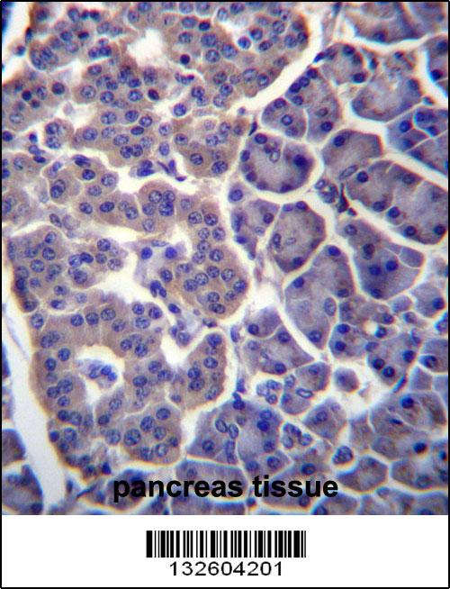 TM9SF2 Antibody (N-term) (Cat. #AP13152a)immunohistochemistry analysis in formalin fixed and paraffin embedded human pancreas tissue followed by peroxidase conjugation of the secondary antibody and DAB staining.This data demonstrates the use of TM9SF2 Antibody (N-term) for immunohistochemistry. Clinical relevance has not been evaluated.