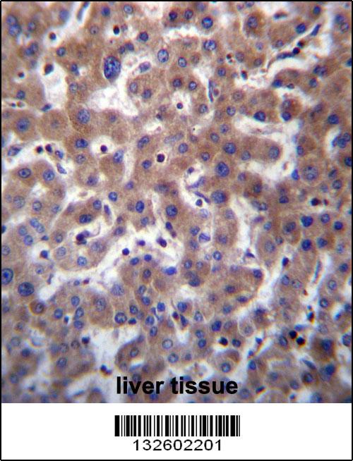 TMBIM1 Antibody (N-term) (Cat. #AP13151a)immunohistochemistry analysis in formalin fixed and paraffin embedded human liver tissue followed by peroxidase conjugation of the secondary antibody and DAB staining.This data demonstrates the use of TMBIM1 Antibody (N-term) for immunohistochemistry. Clinical relevance has not been evaluated.