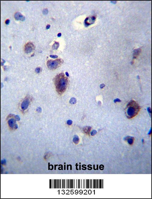 PRLH Antibody (Center) (Cat. #AP13150c)immunohistochemistry analysis in formalin fixed and paraffin embedded human brain tissue followed by peroxidase conjugation of the secondary antibody and DAB staining.This data demonstrates the use of PRLH Antibody (Center) for immunohistochemistry. Clinical relevance has not been evaluated.