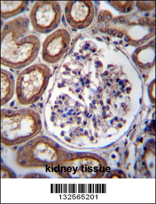 PLS1 Antibody (C-term) (Cat. #AP13147b)immunohistochemistry analysis in formalin fixed and paraffin embedded human kidney tissue followed by peroxidase conjugation of the secondary antibody and DAB staining.This data demonstrates the use of PLS1 Antibody (C-term) for immunohistochemistry. Clinical relevance has not been evaluated.