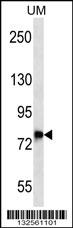 DNAJC14 Antibody (Center) (Cat. #AP13146c) western blot analysis in uterus tumor cell line lysates (35ug/lane).This demonstrates the DNAJC14 antibody detected the DNAJC14 protein (arrow).
