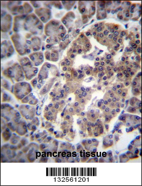 DNAJC14 Antibody (Center) (Cat. #AP13146c)immunohistochemistry analysis in formalin fixed and paraffin embedded human pancreas tissue followed by peroxidase conjugation of the secondary antibody and DAB staining.This data demonstrates the use of DNAJC14 Antibody (Center) for immunohistochemistry. Clinical relevance has not been evaluated.
