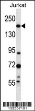 UGCGL1 Antibody (C-term) (Cat. #AP13145b) western blot analysis in Jurkat cell line lysates (35ug/lane).This demonstrates the UGCGL1 antibody detected the UGCGL1 protein (arrow).