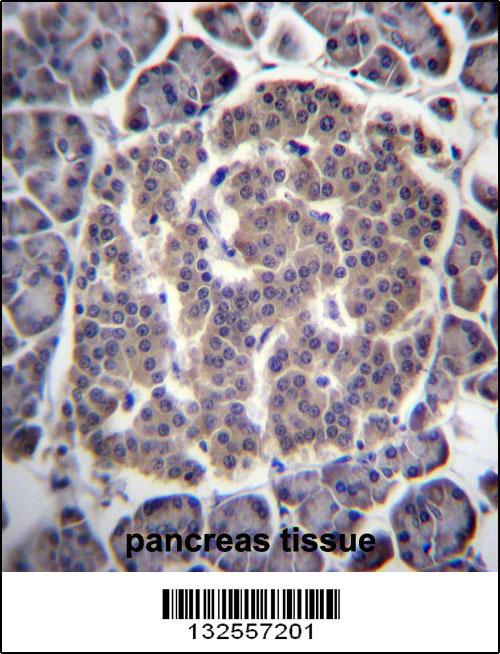 UGCGL1 Antibody (C-term) (Cat. #AP13145b)immunohistochemistry analysis in formalin fixed and paraffin embedded human pancreas tissue followed by peroxidase conjugation of the secondary antibody and DAB staining.This data demonstrates the use of UGCGL1 Antibody (C-term) for immunohistochemistry. Clinical relevance has not been evaluated.
