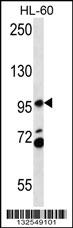 PACS2 Antibody (C-term) (Cat. #AP13142b) western blot analysis in HL-60 cell line lysates (35ug/lane).This demonstrates the PACS2 antibody detected the PACS2 protein (arrow).