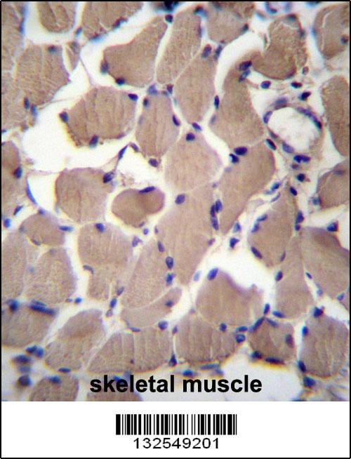 PACS2 Antibody (C-term) (Cat. #AP13142b)immunohistochemistry analysis in formalin fixed and paraffin embedded human skeletal muscle followed by peroxidase conjugation of the secondary antibody and DAB staining.This data demonstrates the use of PACS2 Antibody (C-term) for immunohistochemistry. Clinical relevance has not been evaluated.