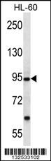 PCDHA12 Antibody (N-term) (Cat. #AP13139a) western blot analysis in HL-60 cell line lysates (35ug/lane).This demonstrates the PCDHA12 antibody detected the PCDHA12 protein (arrow).