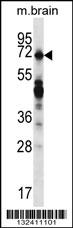 REPS2 Antibody (N-term) (Cat. #AP13131a) western blot analysis in mouse brain tissue lysates (35ug/lane).This demonstrates the REPS2 antibody detected the REPS2 protein (arrow).