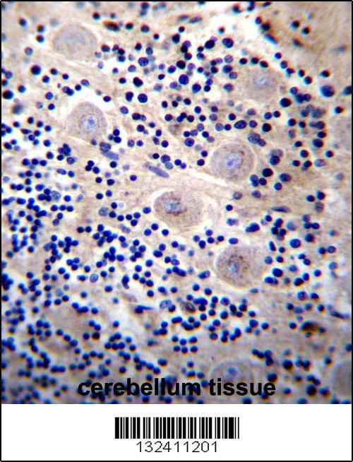 REPS2 Antibody (N-term) (Cat. #AP13131a)immunohistochemistry analysis in formalin fixed and paraffin embedded human cerebellum tissue followed by peroxidase conjugation of the secondary antibody and DAB staining.This data demonstrates the use of REPS2 Antibody (N-term) for immunohistochemistry. Clinical relevance has not been evaluated.