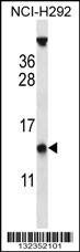 PYDC1 Antibody (Center) (Cat. #AP13124c) western blot analysis in NCI-H292 cell line lysates (35ug/lane).This demonstrates the PYDC1 antibody detected the PYDC1 protein (arrow).