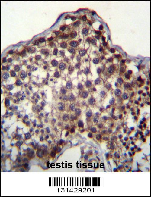 PQLC2 Antibody (C-term) (Cat. #AP13107b)immunohistochemistry analysis in formalin fixed and paraffin embedded human testis tissue followed by peroxidase conjugation of the secondary antibody and DAB staining.This data demonstrates the use of PQLC2 Antibody (C-term) for immunohistochemistry. Clinical relevance has not been evaluated.