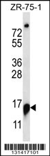 RPP25 Antibody (C-term) (Cat. #AP13106b) western blot analysis in ZR-75-1 cell line lysates (35ug/lane).This demonstrates the RPP25 antibody detected the RPP25 protein (arrow).