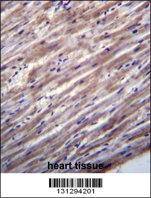 RASD1 Antibody (C-term) (Cat. #AP13102b)immunohistochemistry analysis in formalin fixed and paraffin embedded human heart tissue followed by peroxidase conjugation of the secondary antibody and DAB staining.This data demonstrates the use of RASD1 Antibody (C-term) for immunohistochemistry. Clinical relevance has not been evaluated.