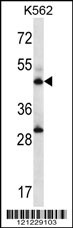 ADSS Antibody (C-term) (Cat. #AP13092b) western blot analysis in K562 cell line lysates (35ug/lane).This demonstrates the ADSS antibody detected the ADSS protein (arrow).