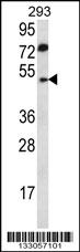 ABHD2 Antibody (Center) (Cat. #AP13083c) western blot analysis in 293 cell line lysates (35ug/lane).This demonstrates the ABHD2 antibody detected the ABHD2 protein (arrow).