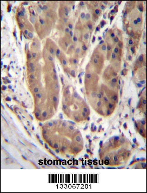 ABHD2 Antibody (Center) (Cat. #AP13083c)immunohistochemistry analysis in formalin fixed and paraffin embedded human stomach tissue followed by peroxidase conjugation of the secondary antibody and DAB staining.This data demonstrates the use of ABHD2 Antibody (Center) for immunohistochemistry. Clinical relevance has not been evaluated.