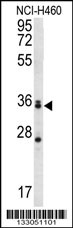 MBNL3 Antibody (Center) (Cat. #AP13080c) western blot analysis in NCI-H460 cell line lysates (35ug/lane).This demonstrates the MBNL3 antibody detected the MBNL3 protein (arrow).