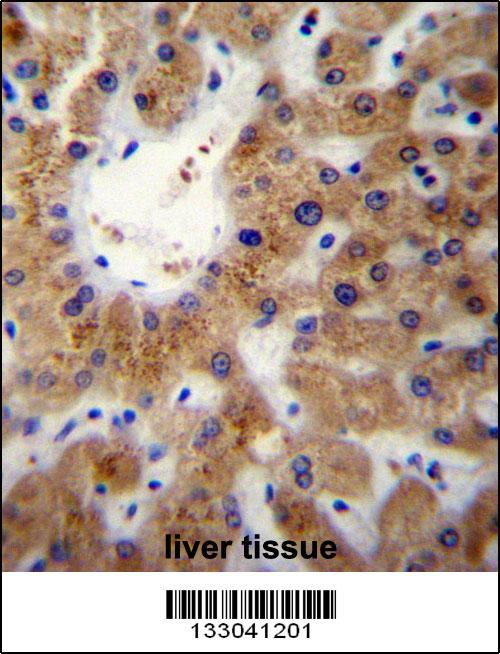 ERLIN1 Antibody (Center) (Cat. #AP13078c)immunohistochemistry analysis in formalin fixed and paraffin embedded human liver tissue followed by peroxidase conjugation of the secondary antibody and DAB staining.This data demonstrates the use of ERLIN1 Antibody (Center) for immunohistochemistry. Clinical relevance has not been evaluated.