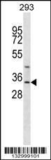 GLYAT Antibody (Center) (Cat. #AP13064c) western blot analysis in 293 cell line lysates (35ug/lane).This demonstrates the GLYAT antibody detected the GLYAT protein (arrow).