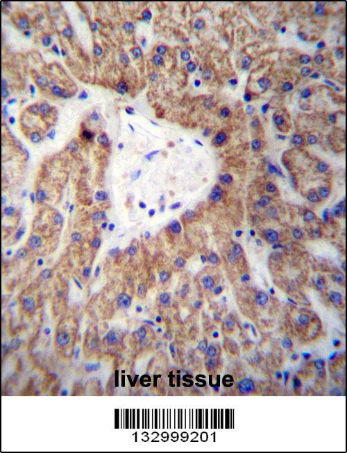 GLYAT Antibody (Center) (Cat. #AP13064c)immunohistochemistry analysis in formalin fixed and paraffin embedded human liver tissue followed by peroxidase conjugation of the secondary antibody and DAB staining.This data demonstrates the use of GLYAT Antibody (Center) for immunohistochemistry. Clinical relevance has not been evaluated.