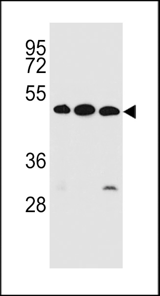 KREMEN2 Antibody (Center) (Cat. #AP13054c) western blot analysis in ZR-75-1,K562,NCI-H460 cell line lysates (35ug/lane).This demonstrates the KREMEN2 antibody detected the KREMEN2 protein (arrow).