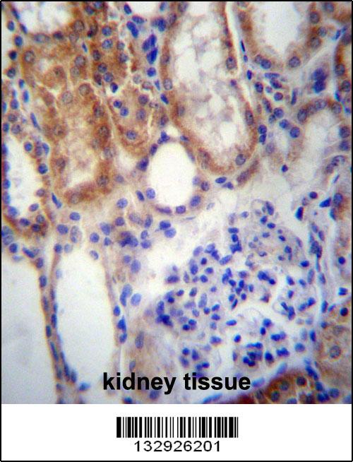 SUSD2 Antibody (C-term) (Cat. #AP13050b)immunohistochemistry analysis in formalin fixed and paraffin embedded human kidney tissue followed by peroxidase conjugation of the secondary antibody and DAB staining.This data demonstrates the use of SUSD2 Antibody (C-term) for immunohistochemistry. Clinical relevance has not been evaluated.