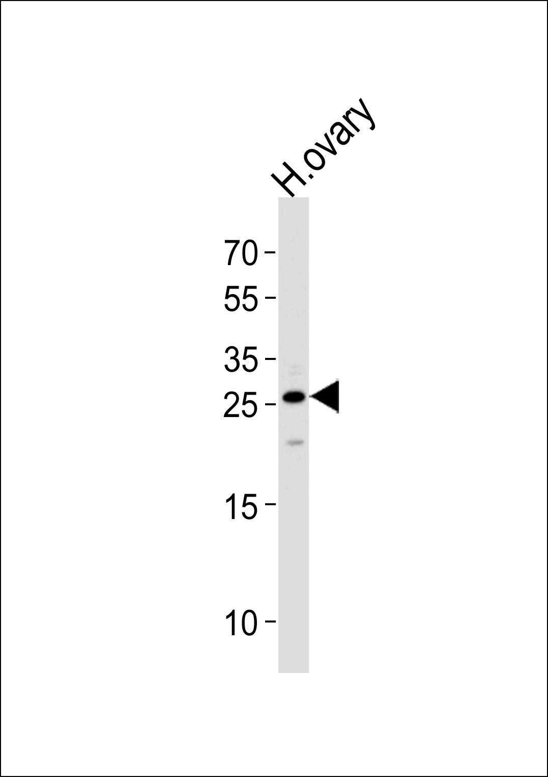 Western blot analysis of lysate from human ovary tissue lysate, using CCDC90B Antibody (Center)(Cat. #AP13045c). AP13045c was diluted at 1:1000 at each lane. A goat anti-rabbit IgG H&L(HRP) at 1:5000 dilution was used as the secondary antibody. Lysate at 35ug per lane. 