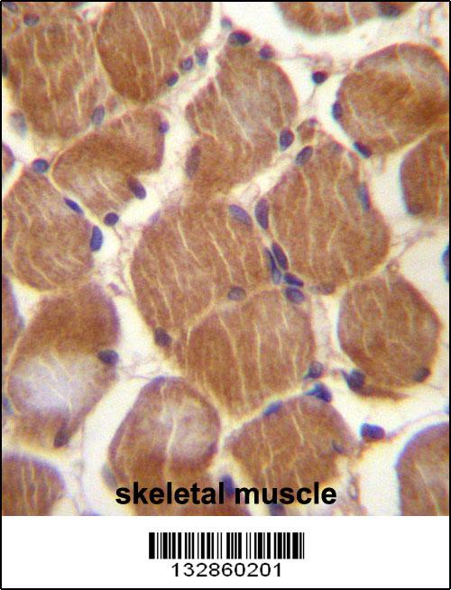 ASAM Antibody (Center) (Cat. #AP13037c)immunohistochemistry analysis in formalin fixed and paraffin embedded human skeletal muscle followed by peroxidase conjugation of the secondary antibody and DAB staining.This data demonstrates the use of ASAM Antibody (Center) for immunohistochemistry. Clinical relevance has not been evaluated.
