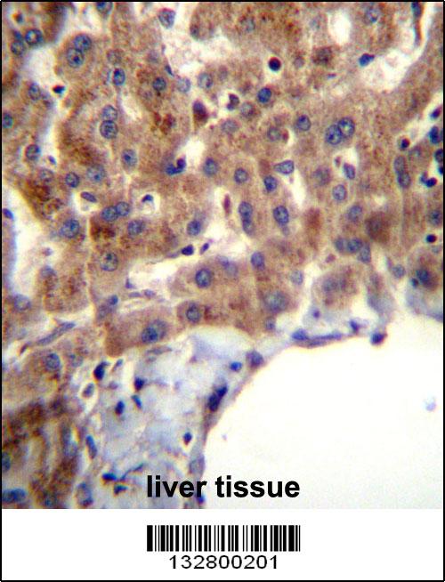 MBNL2 Antibody (C-term) (Cat. #AP13023b)immunohistochemistry analysis in formalin fixed and paraffin embedded human liver tissue followed by peroxidase conjugation of the secondary antibody and DAB staining.This data demonstrates the use of MBNL2 Antibody (C-term) for immunohistochemistry. Clinical relevance has not been evaluated.