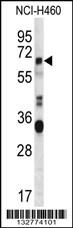 HERV-FRD Antibody (N-term) (Cat. #AP13018a) western blot analysis in NCI-H460 cell line lysates (35ug/lane).This demonstrates the HERV-FRD antibody detected the HERV-FRD protein (arrow).