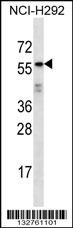 ODF2L Antibody (C-term) (Cat. #AP13014b) western blot analysis in NCI-H292 cell line lysates (35ug/lane).This demonstrates the ODF2L antibody detected the ODF2L protein (arrow).