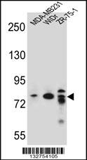 ARHGAP22 Antibody (C-term) (Cat. #AP13013b) western blot analysis in MDA-MB231,WiDr,ZR-75-1 cell line lysates (35ug/lane).This demonstrates the ARHGAP22 antibody detected the ARHGAP22 protein (arrow).