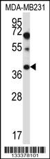 PTPLA Antibody (N-term) (Cat. #AP13486a) western blot analysis in MDA-MB231 cell line lysates (35ug/lane).This demonstrates the PTPLA antibody detected the PTPLA protein (arrow).